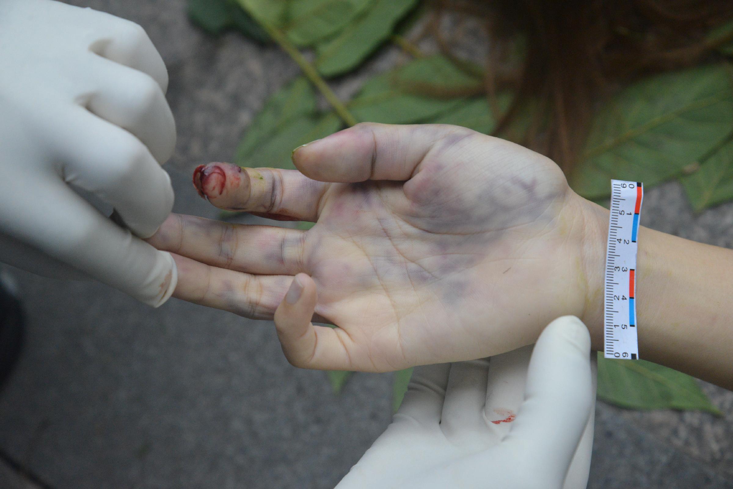 Poor Chinese Woman Murdered.