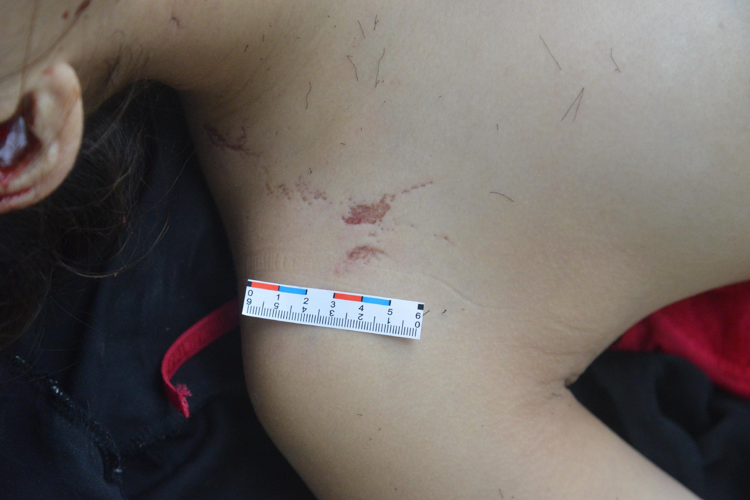 Poor Chinese Woman Murdered.