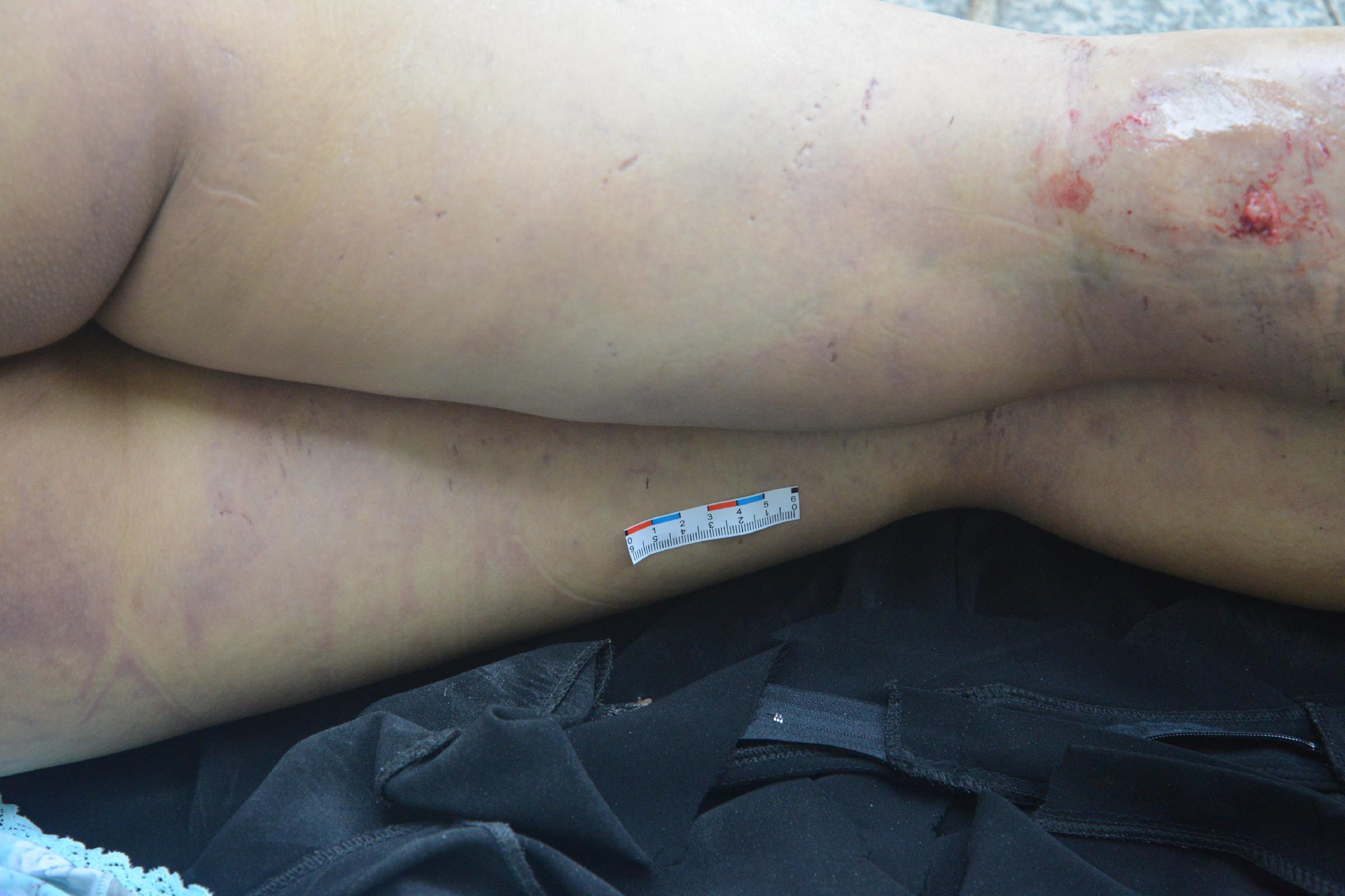 Poor Chinese Woman Murdered.