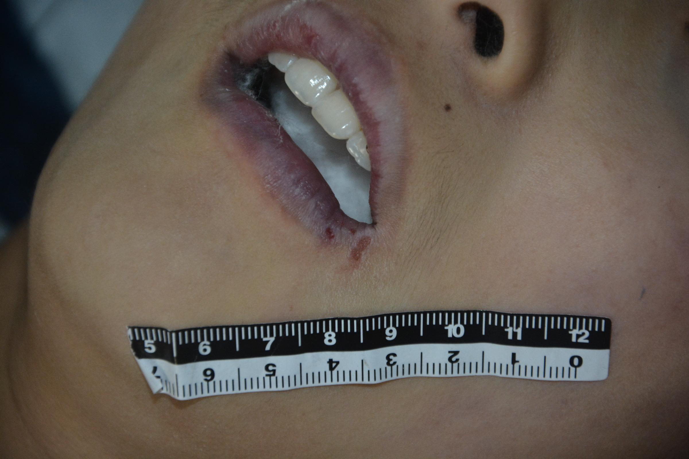 Pretty Chinese girl naked in morgue