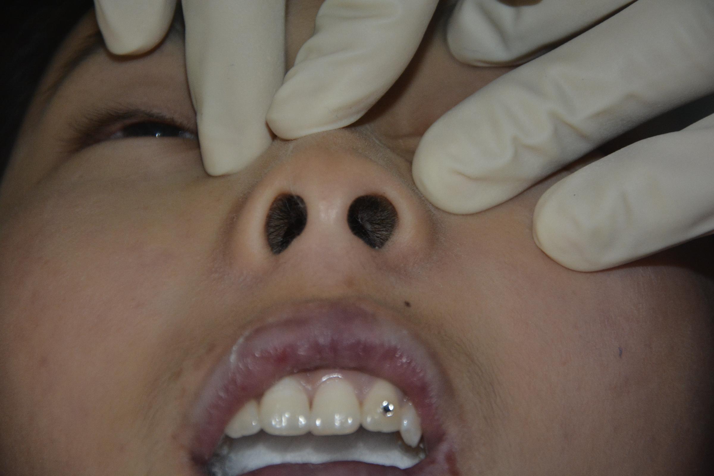 Pretty Chinese girl naked in morgue