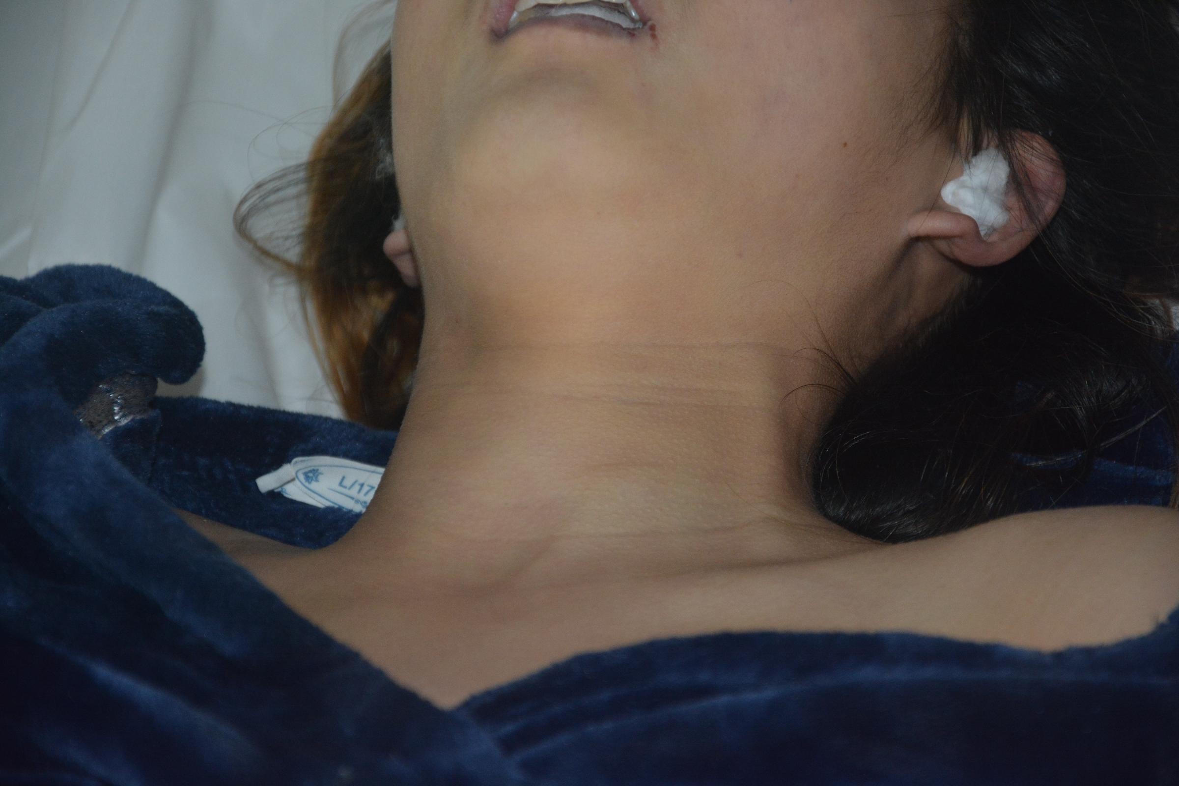 Pretty Chinese girl naked in morgue