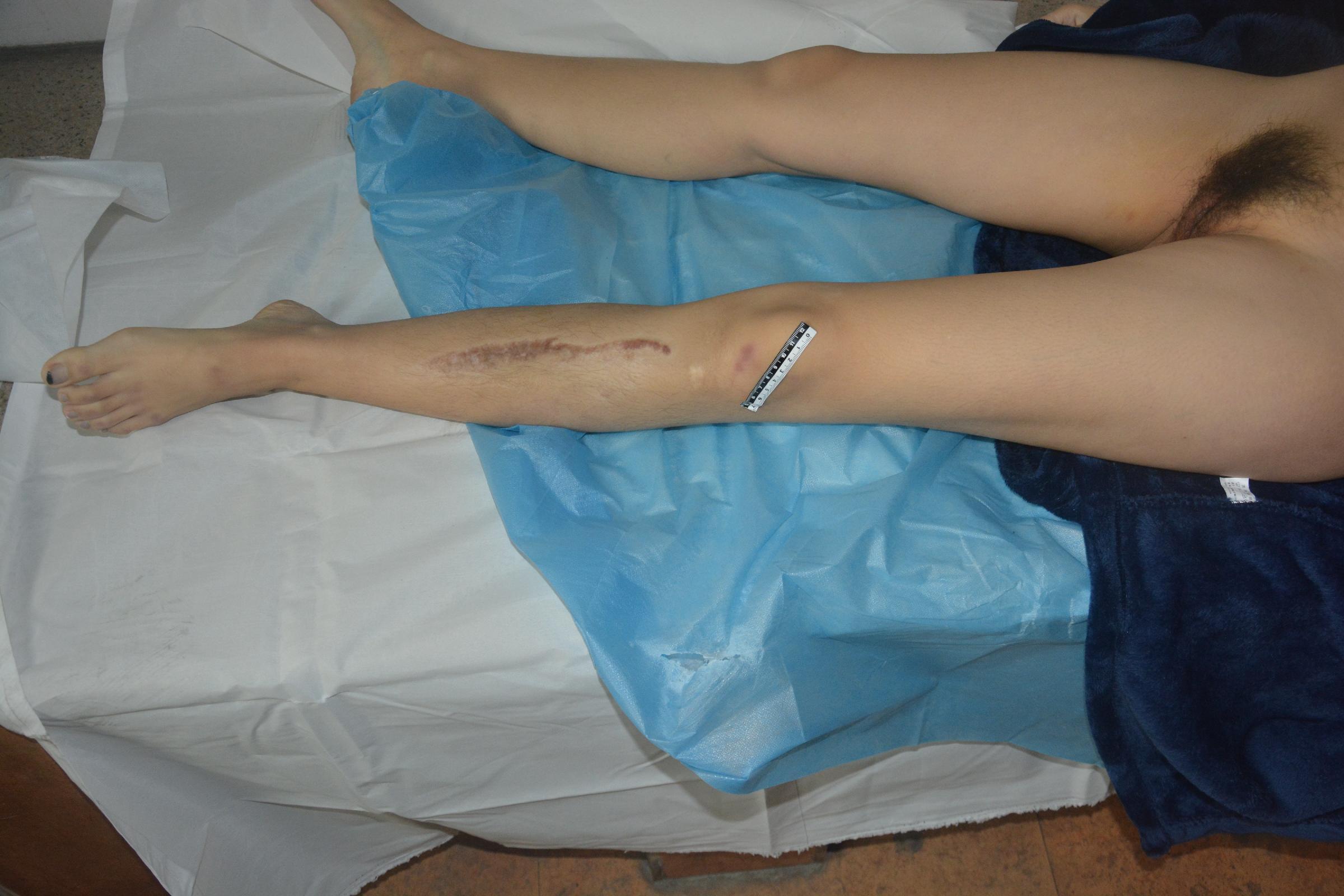 Pretty Chinese girl naked in morgue