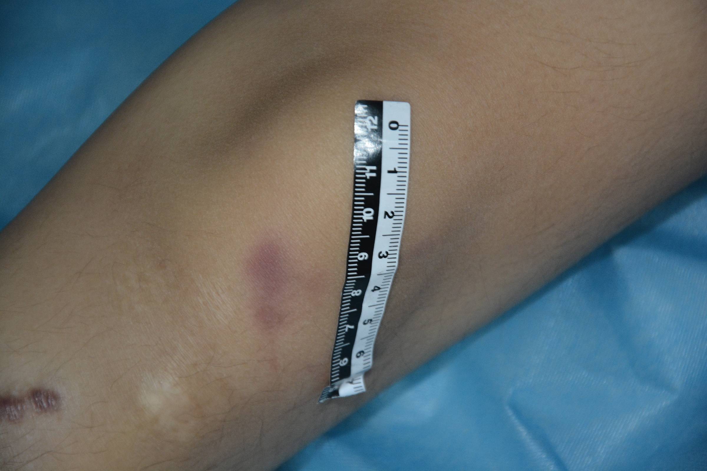 Pretty Chinese girl naked in morgue