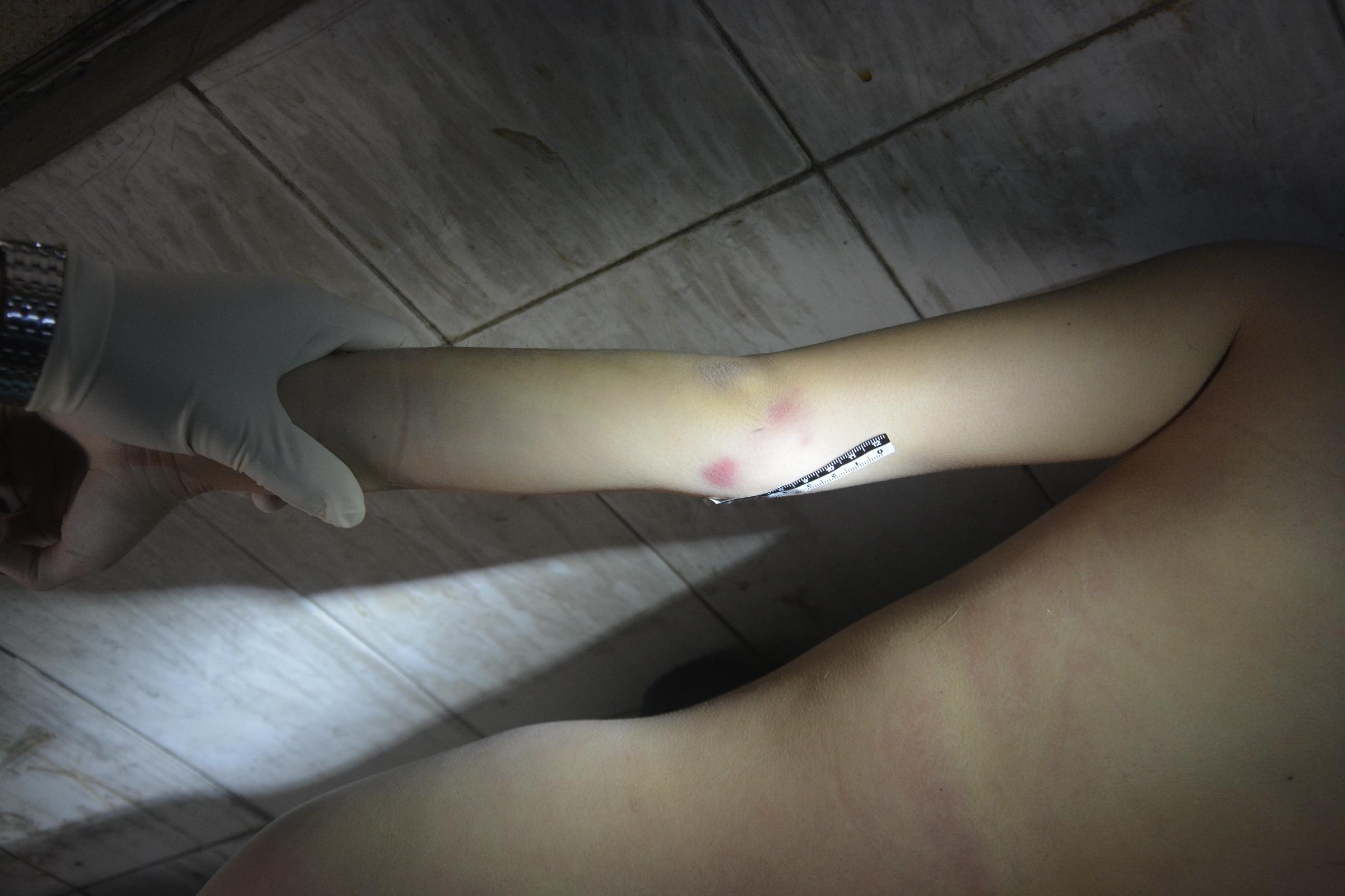 Pretty Chinese girl naked in morgue