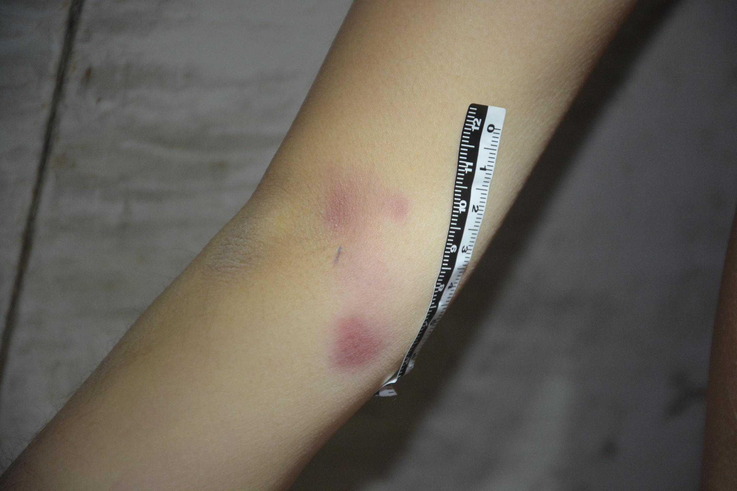 Pretty Chinese girl naked in morgue