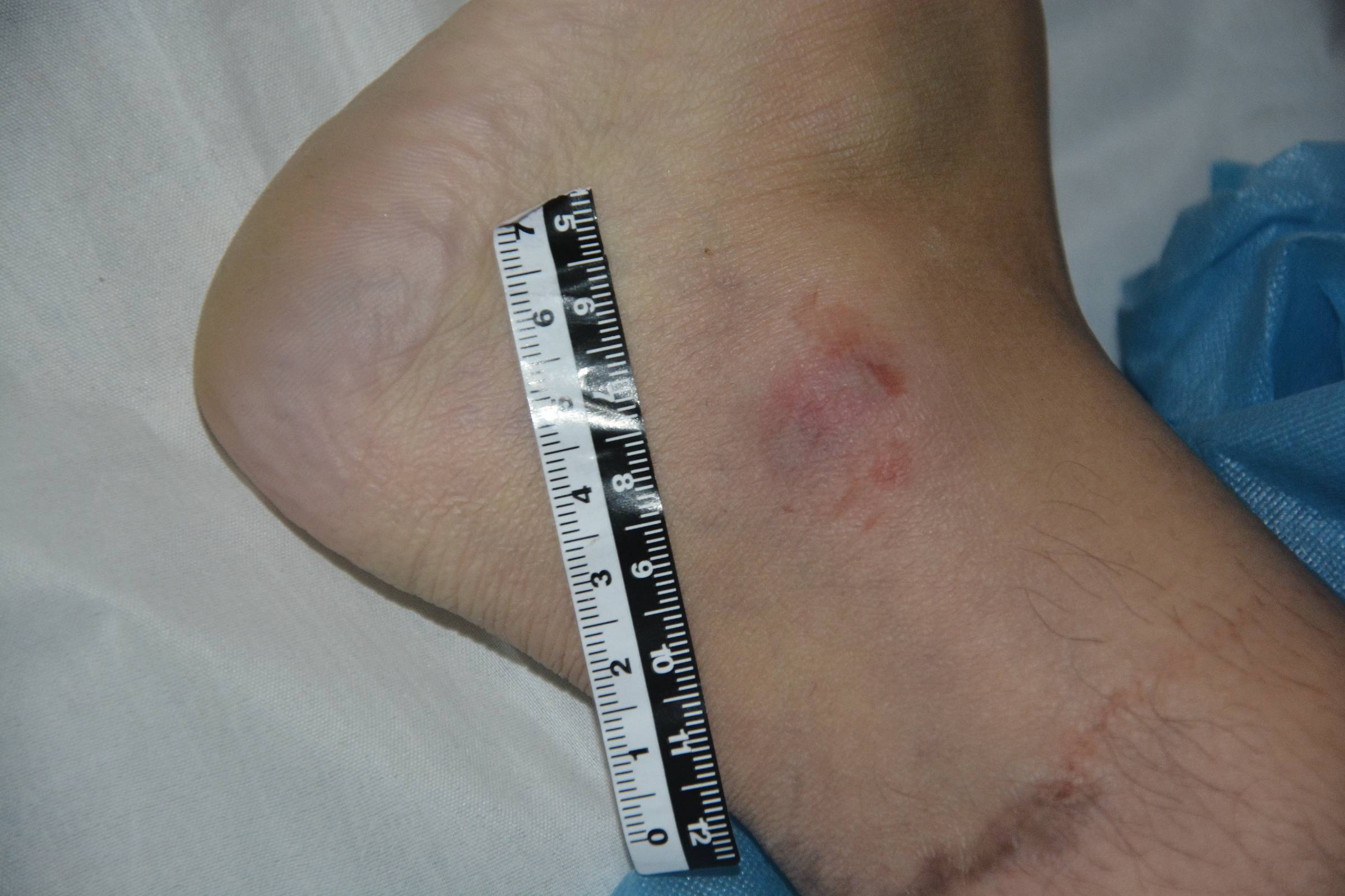 Pretty Chinese girl naked in morgue