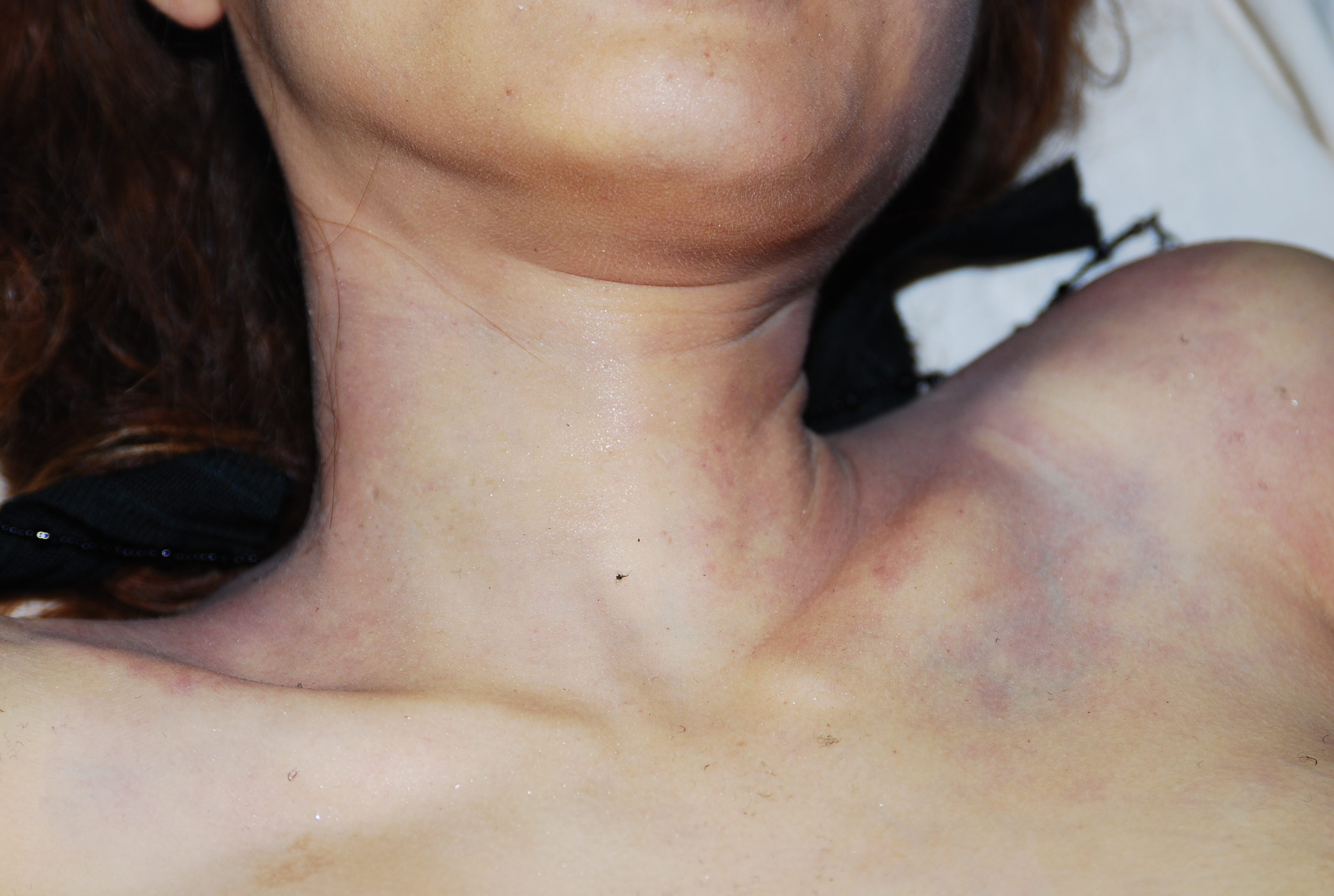 Chinese woman naked in morgue