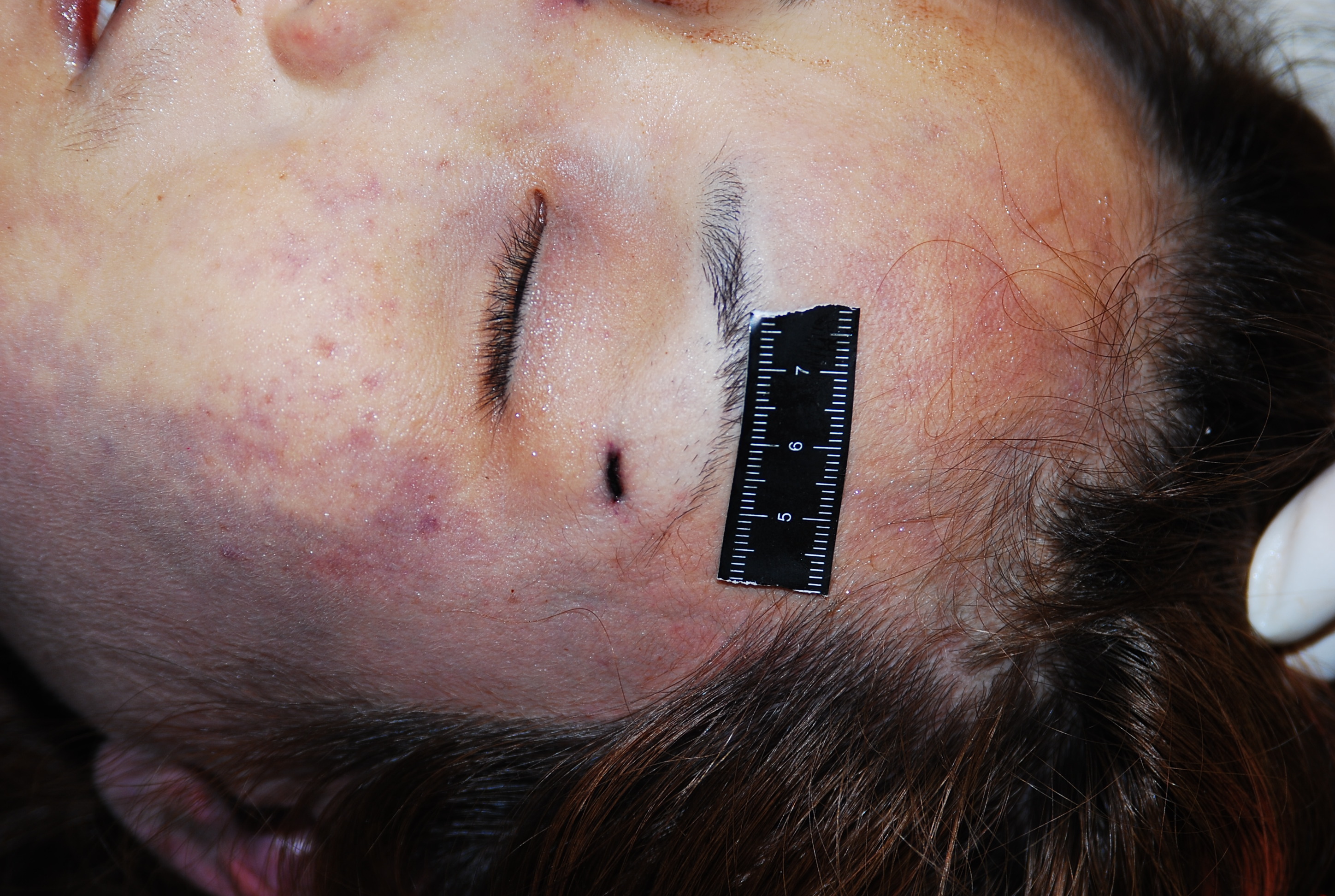 Chinese woman naked in morgue