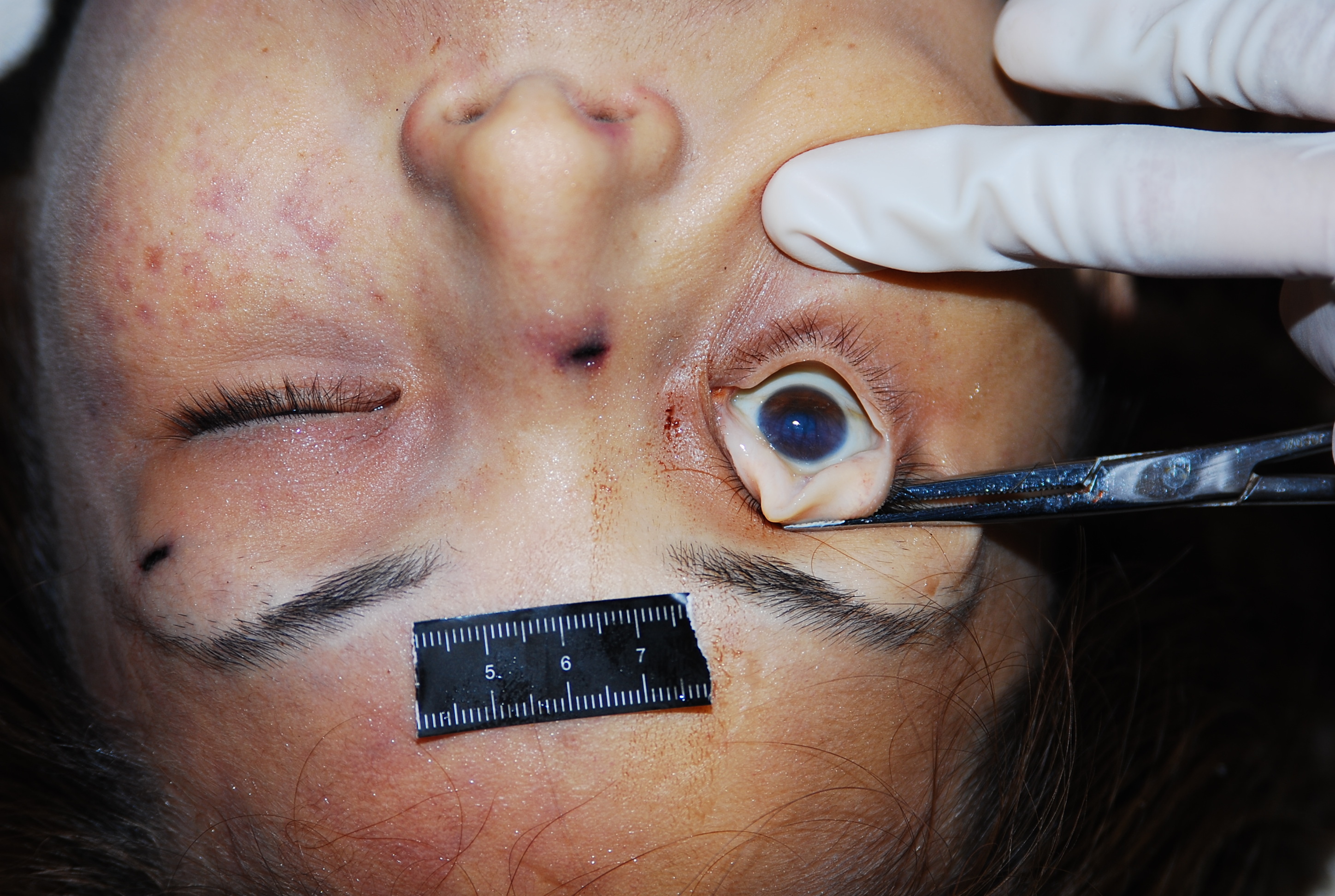 Chinese woman naked in morgue