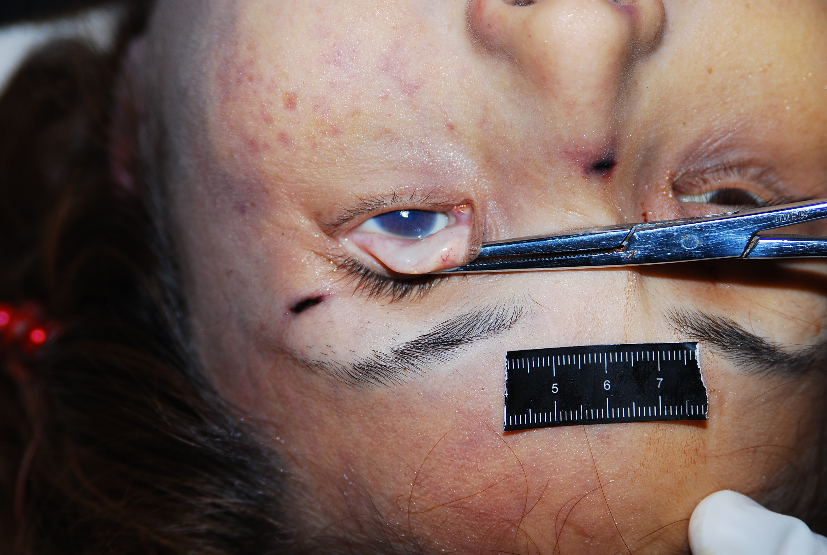 Chinese woman naked in morgue