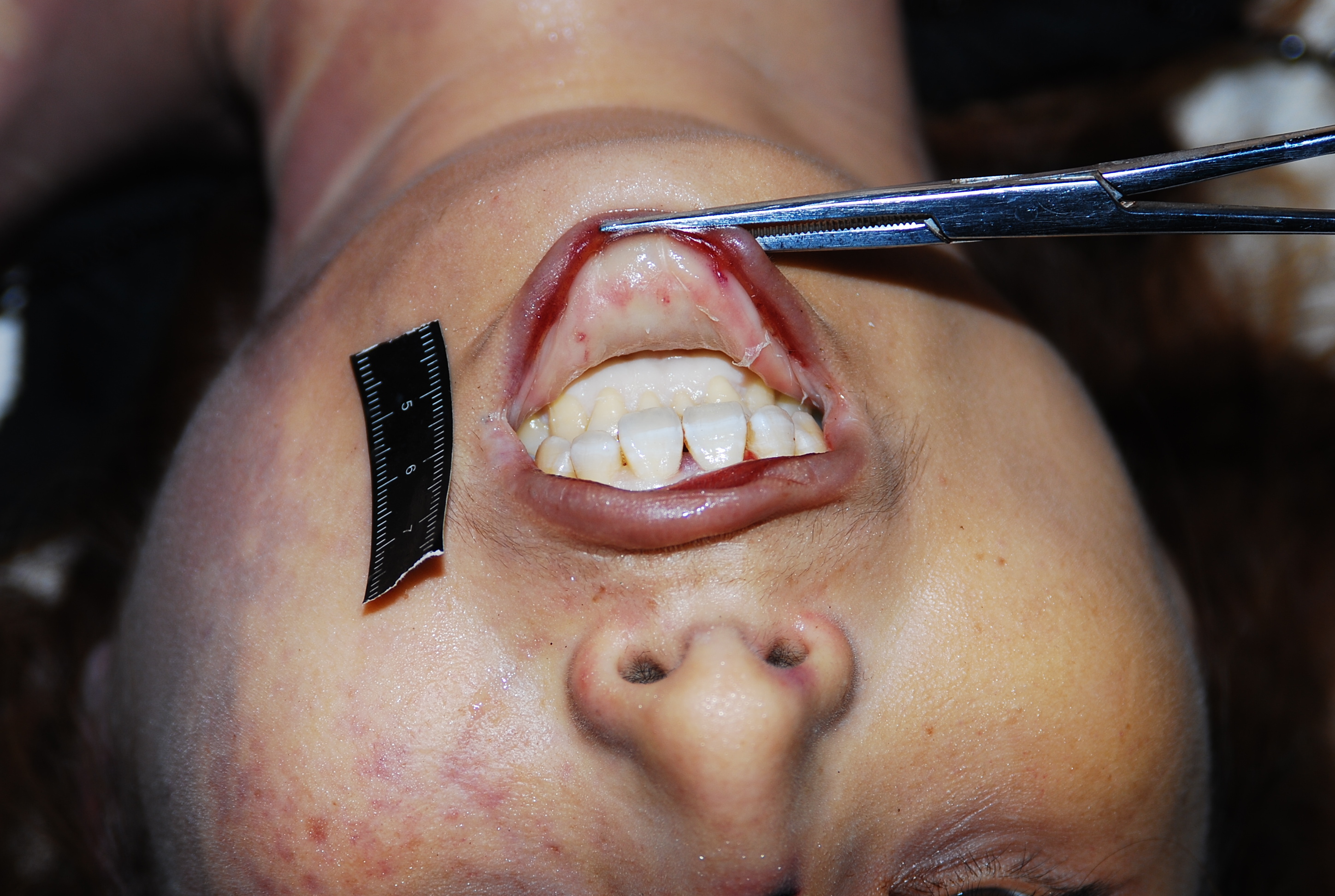 Chinese woman naked in morgue