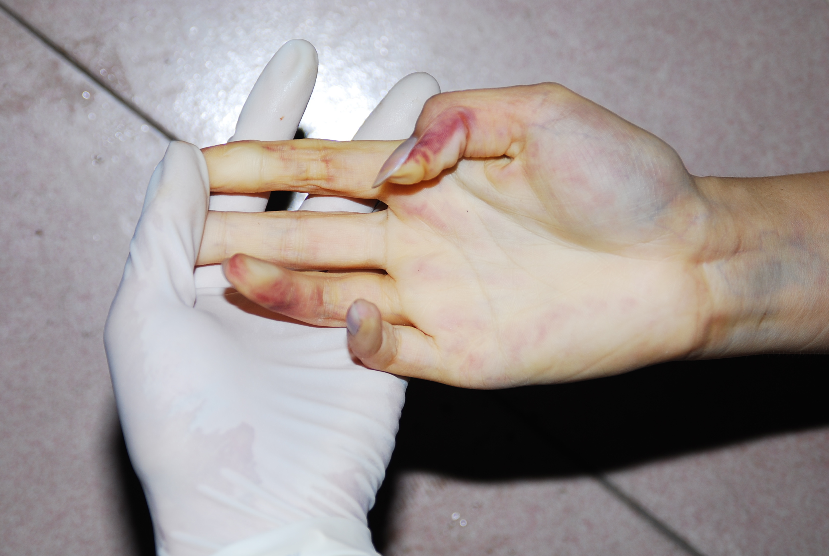 Chinese woman naked in morgue