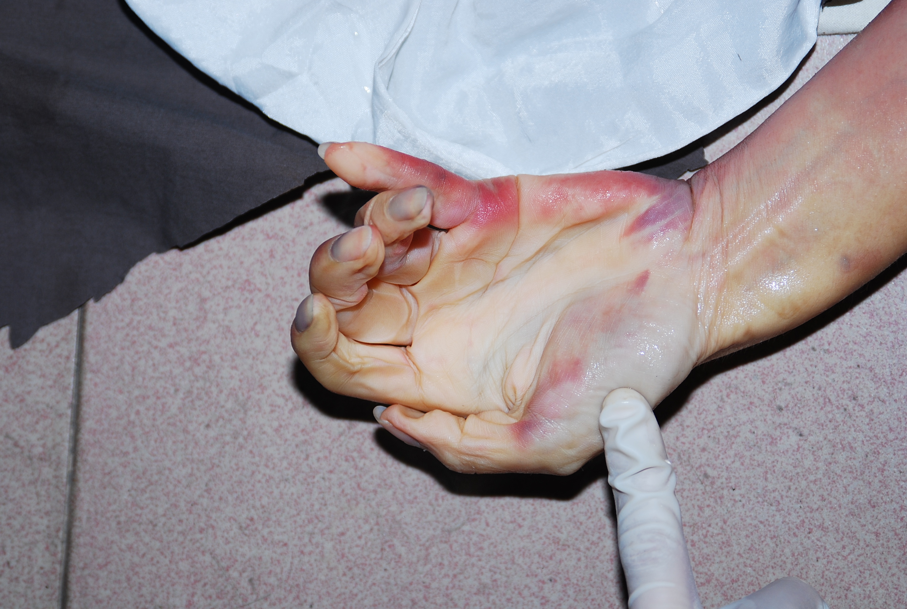 Chinese woman naked in morgue