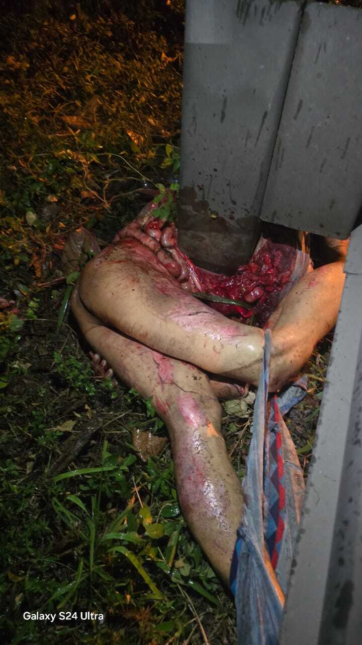 AFTERMATH : PEDESTRIAN HIT BY A SPEEDING CAR