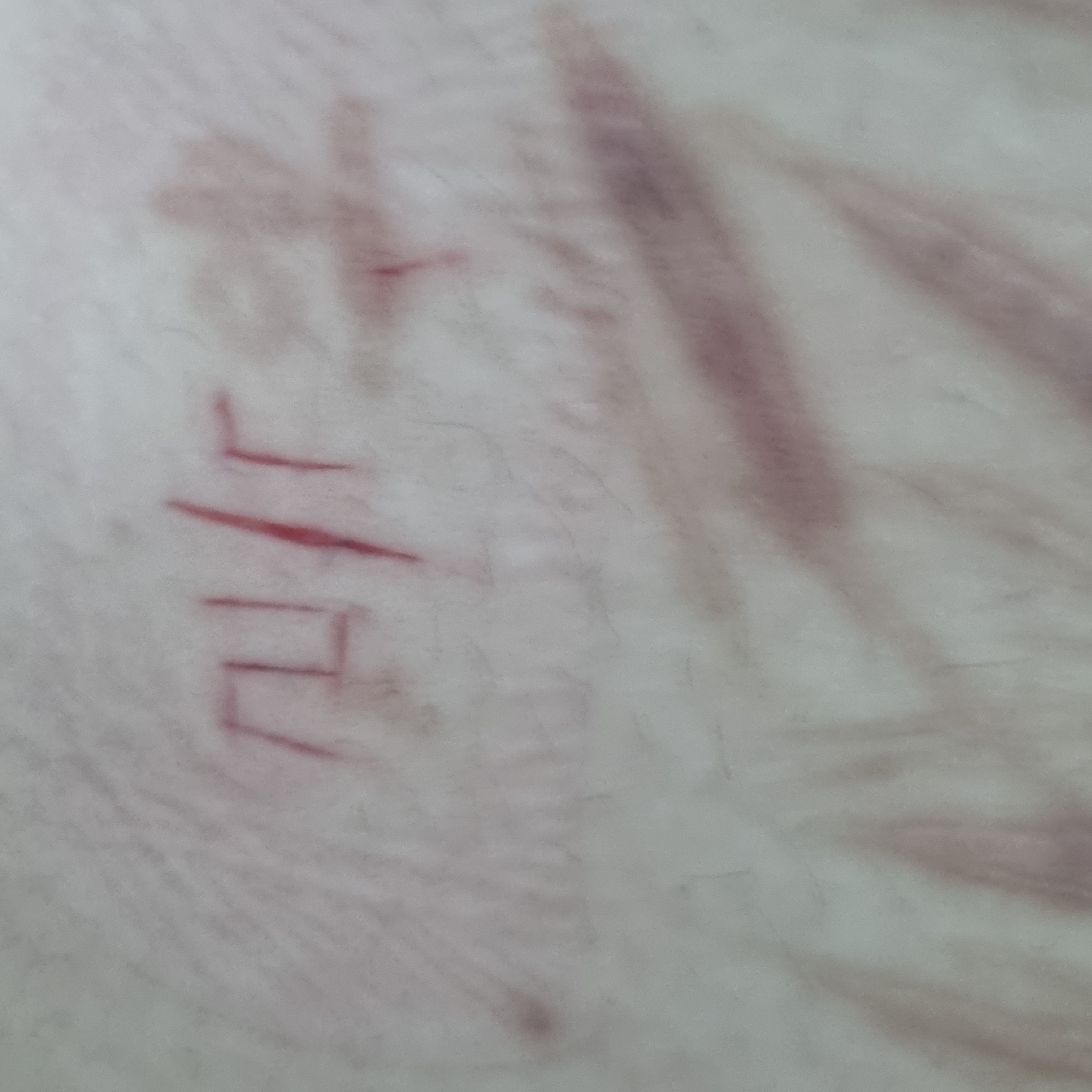 Photos of the KOREAN GIRL who LIVESTREAMS HER SUICIDE