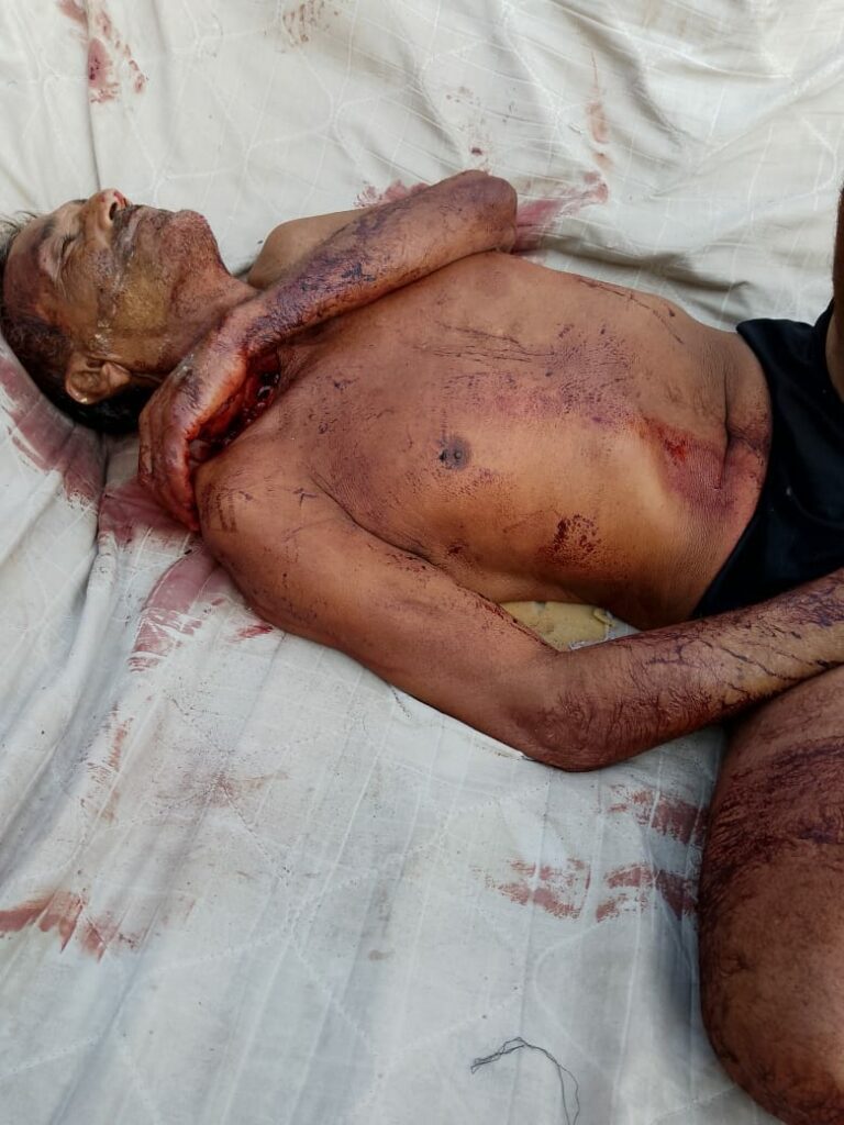 Murdered with several stab wounds to the body