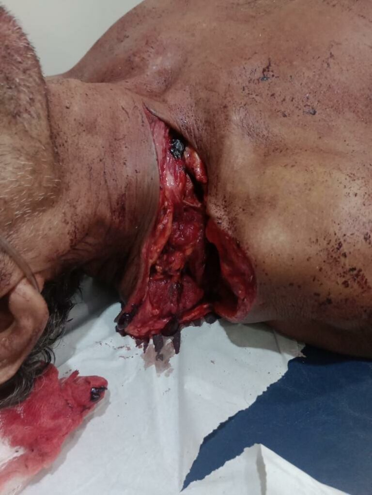 Murdered with several stab wounds to the body