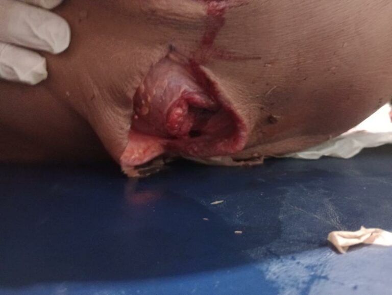 Murdered with several stab wounds to the body