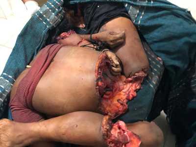 Beautiful Girl Chopped to Pieces (Perfect Body)