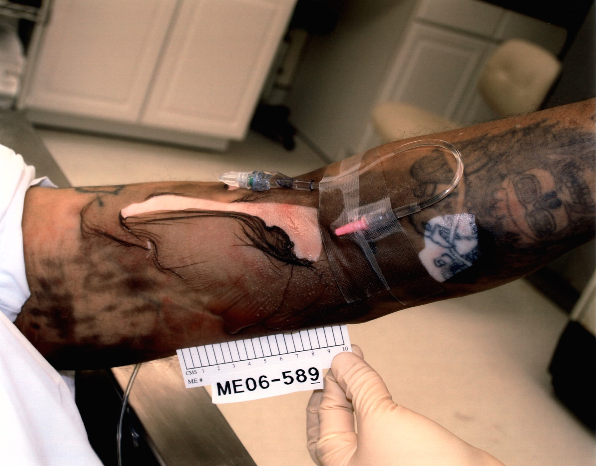DAMN: Photos from a Botched Lethal Injection