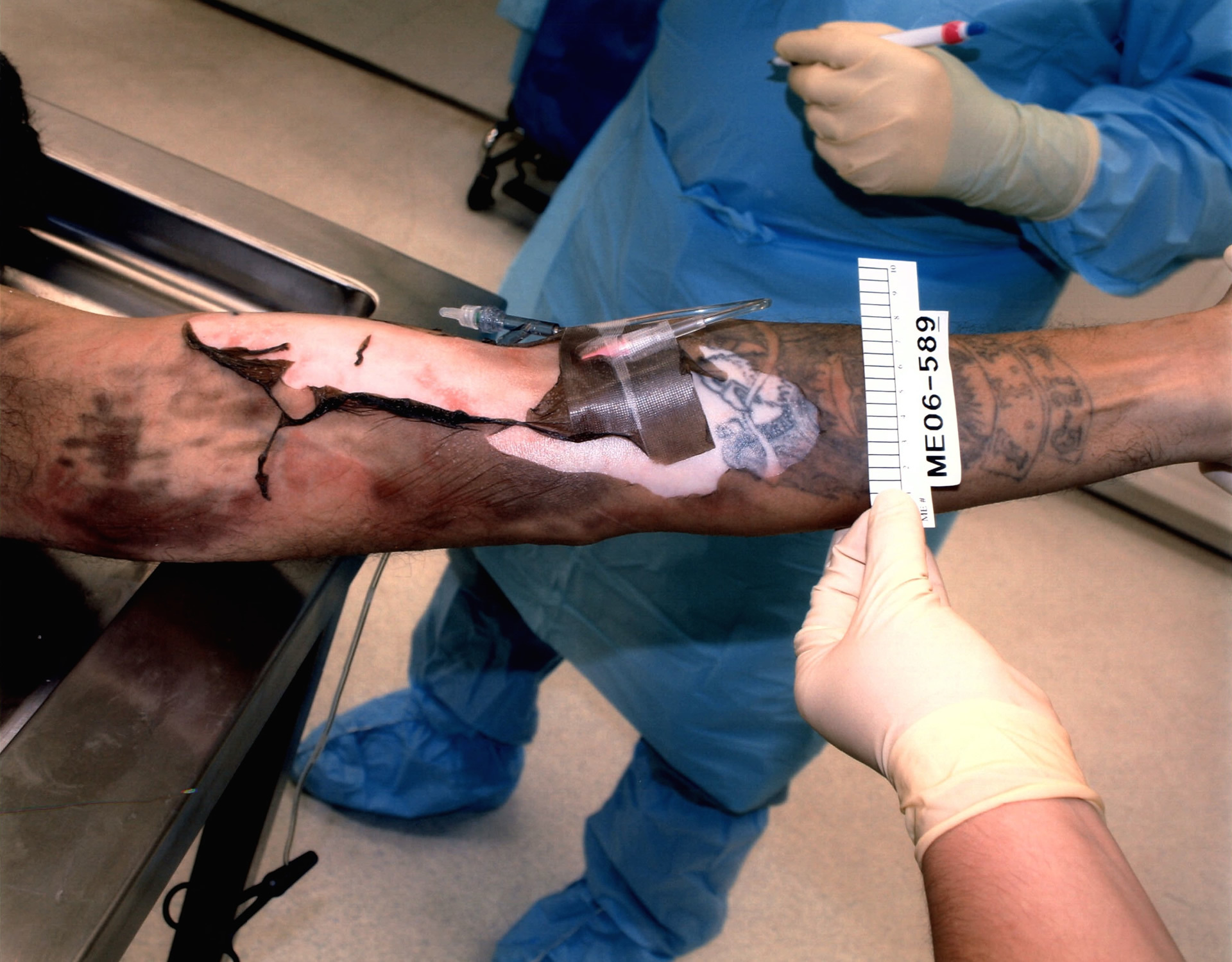 DAMN: Photos from a Botched Lethal Injection