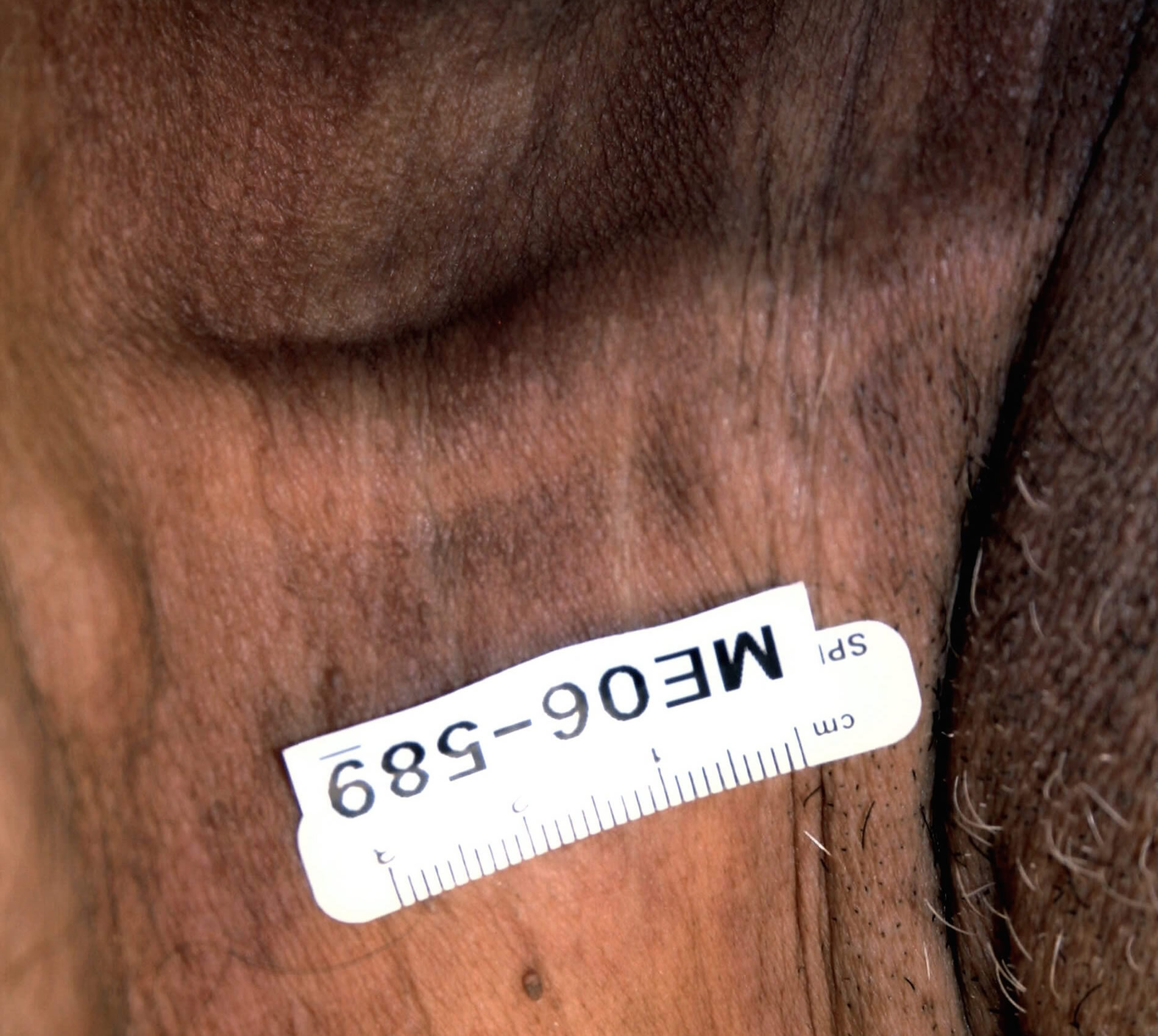 DAMN: Photos from a Botched Lethal Injection