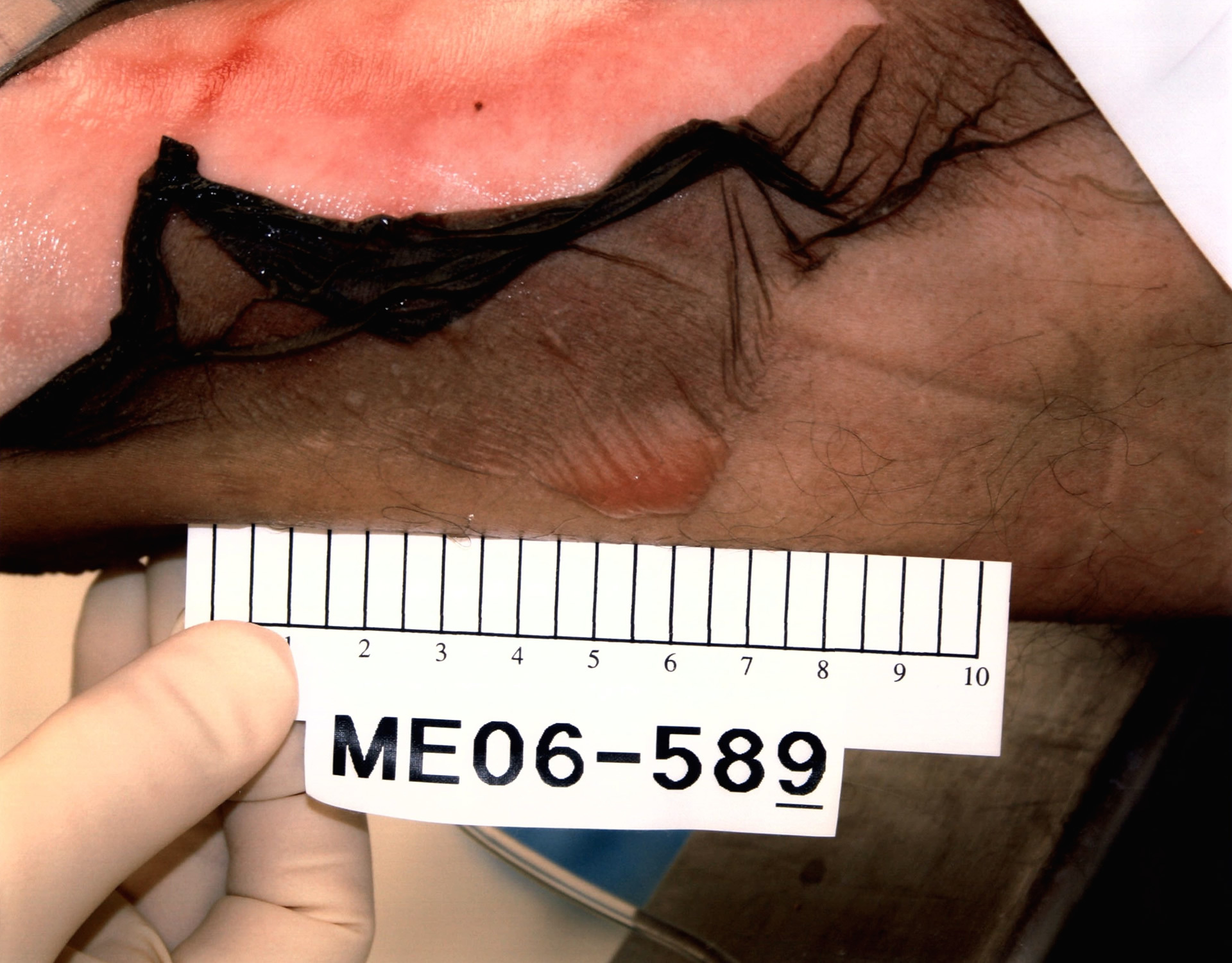 DAMN: Photos from a Botched Lethal Injection