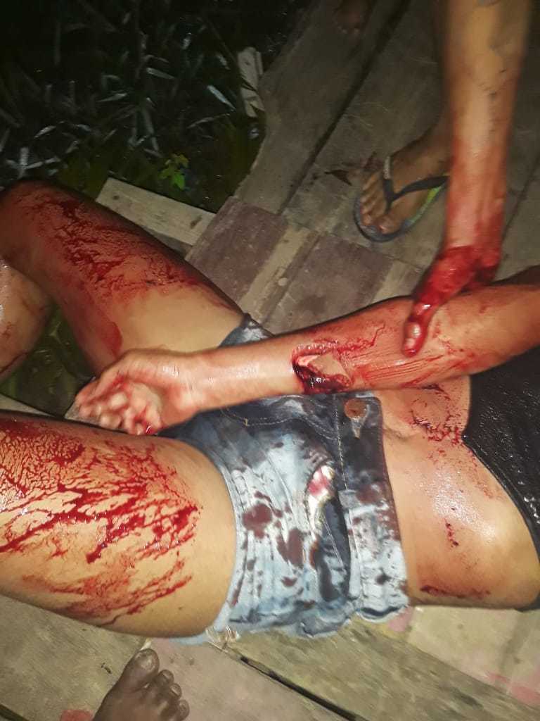 Pretty Woman Slashed and Stabbed to Death.