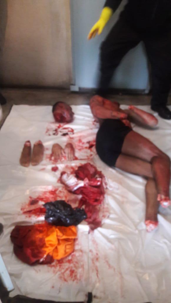 Dismembered Cellmate in Brazilian Prison