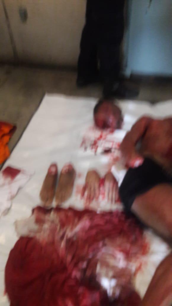 Dismembered Cellmate in Brazilian Prison