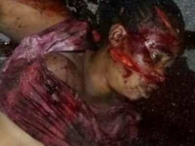 prostitute dead after brutal machete attack