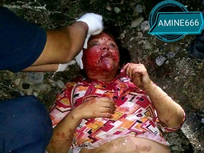 unfaithful wife burned by husband