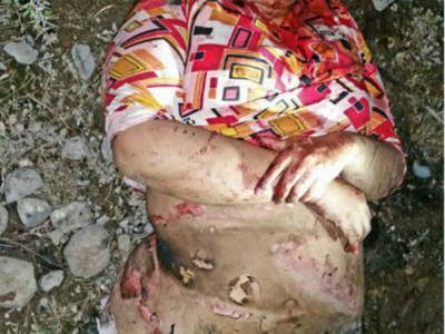 unfaithful wife burned by husband