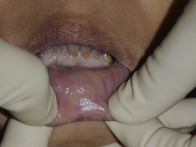 Autopsy of a Chinese woman with a good figure and nice body 