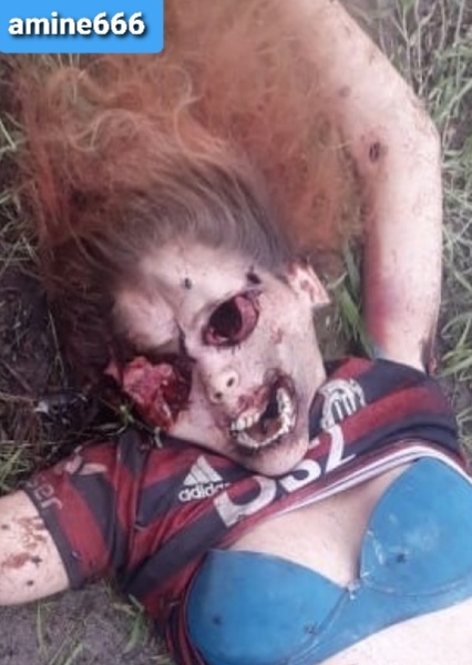 Young Lady Brutally Murdered Missing Eyes