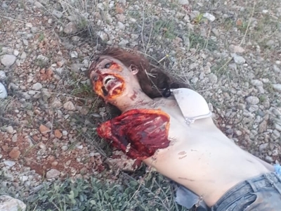 Young girl from Lebanon killed and dogs eat parts of the dead body 