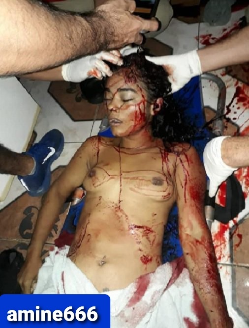 Topless Cute Brazilian Woman Killed