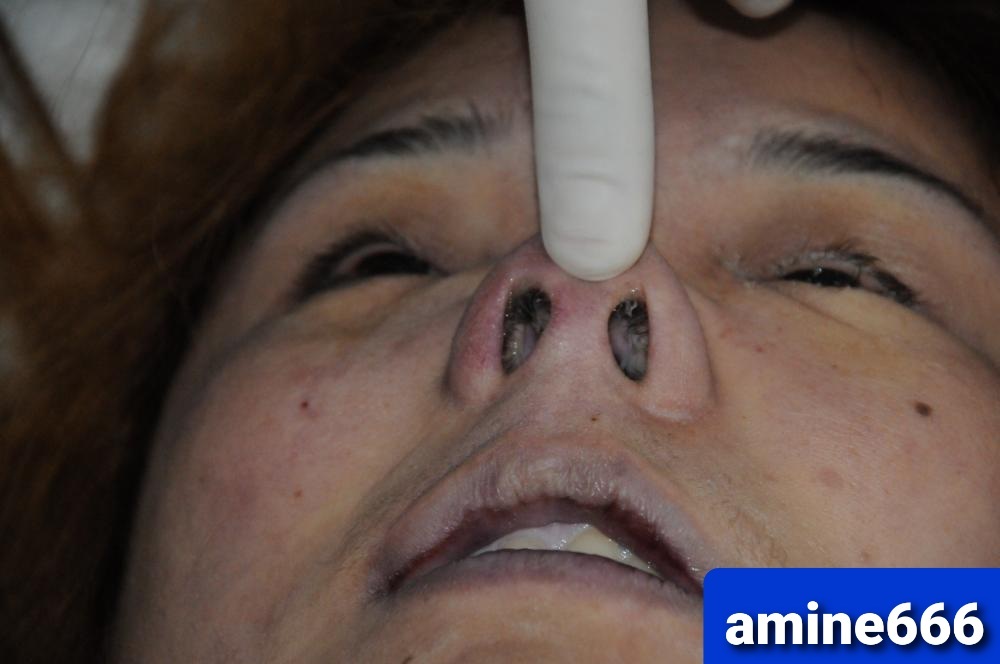 Chinese hooker strangled to death by client in hotel room