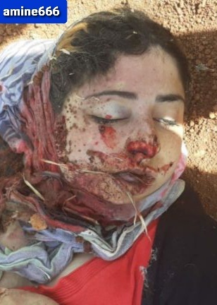 16-year-old Kurdish Girl, Killed by Turkish Mercenaries.