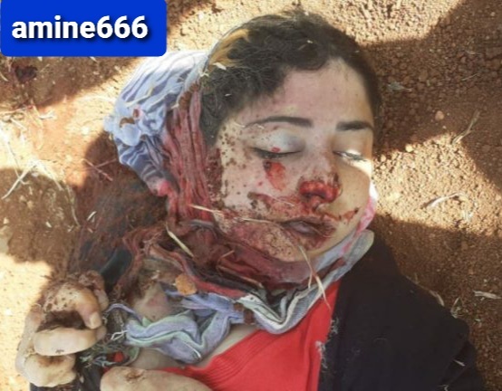 16-year-old Kurdish Girl, Killed by Turkish Mercenaries.