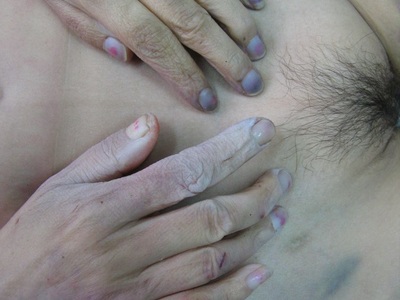 Examination of dead Chinese woman. 