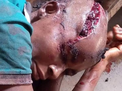 Husband sliced open his wife's head with machete.