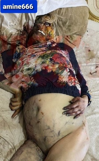 Old Woman Dies in Her Bed So Her Starving Dog Eats Her Face