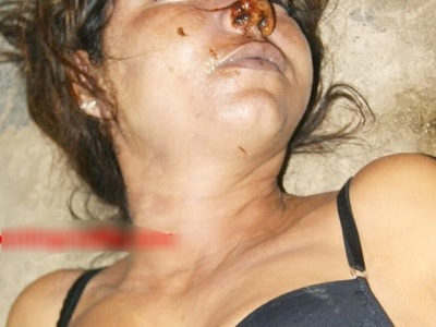 Drug user woman died from overdose 