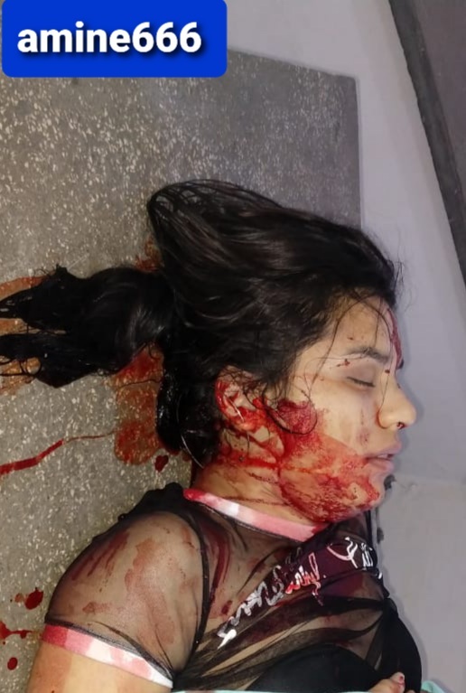 Girl Takes a Fatal Round During Shootout, Brazil.