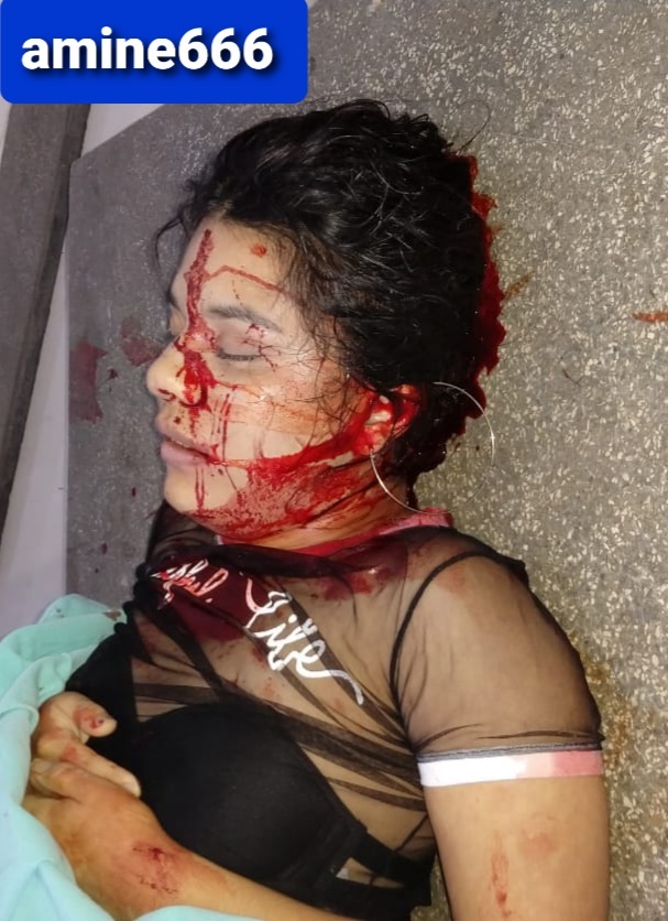 Girl Takes a Fatal Round During Shootout, Brazil.