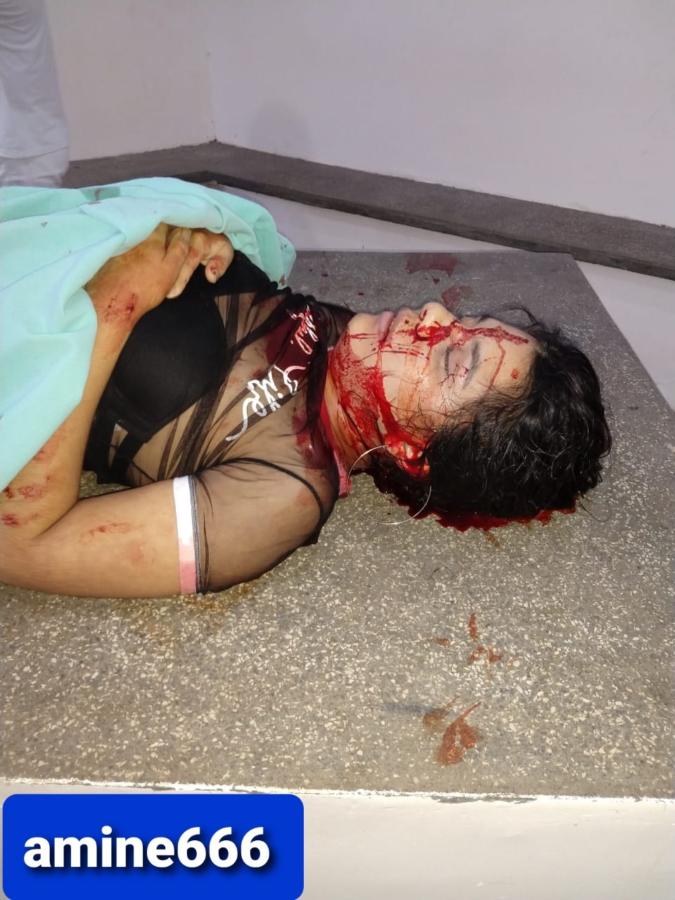 Girl Takes a Fatal Round During Shootout, Brazil.