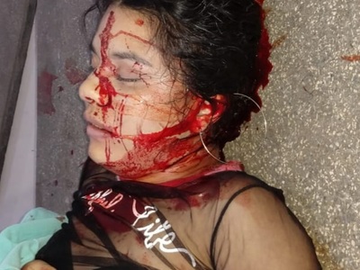 19 year old girl shot dead by police during ambush with drug dealers.