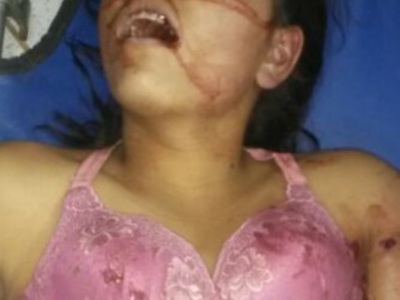 Young Colombian woman killed by stray bullet 